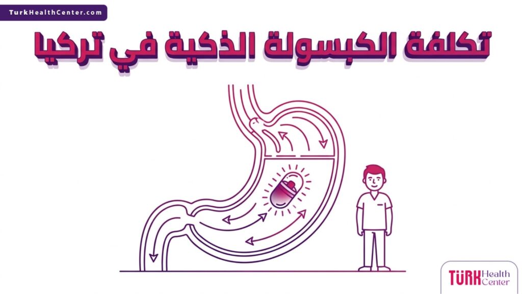 رسم توضيحي طبي يظهر آلية عمل المعدة وارتباطها بموضوع تكلفة الكبسولة الذكية في تركيا