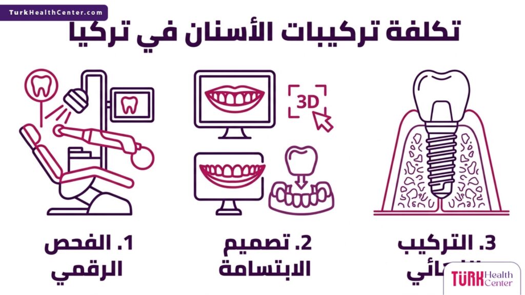 مخطط إنفوجرافيك يوضح الخطوات الثلاث الأساسية لتحديد تكلفة تركيبات الأسنان في تركيا.