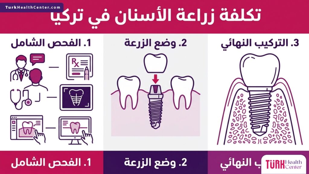 إنفوجرافيك تفصيلي يوضح المراحل الأساسية المتعلقة بموضوع تكلفة زراعة الأسنان في تركيا