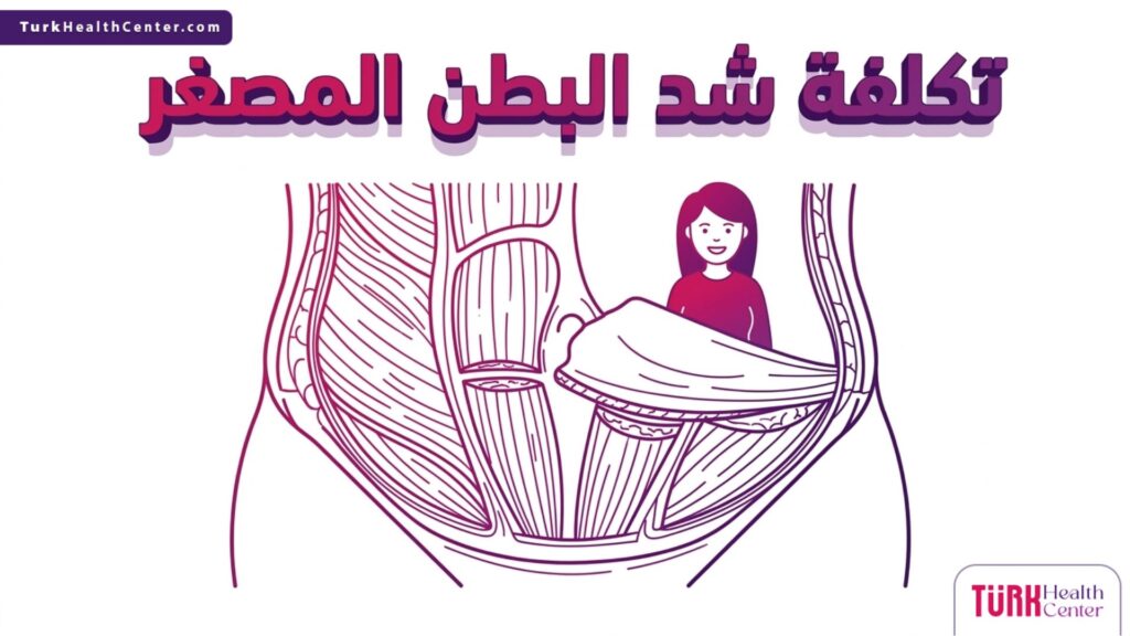 رسم توضيحي طبي يشرح التشريح الداخلي لمنطقة أسفل البطن وما تتضمنه تكلفة شد البطن المصغر.