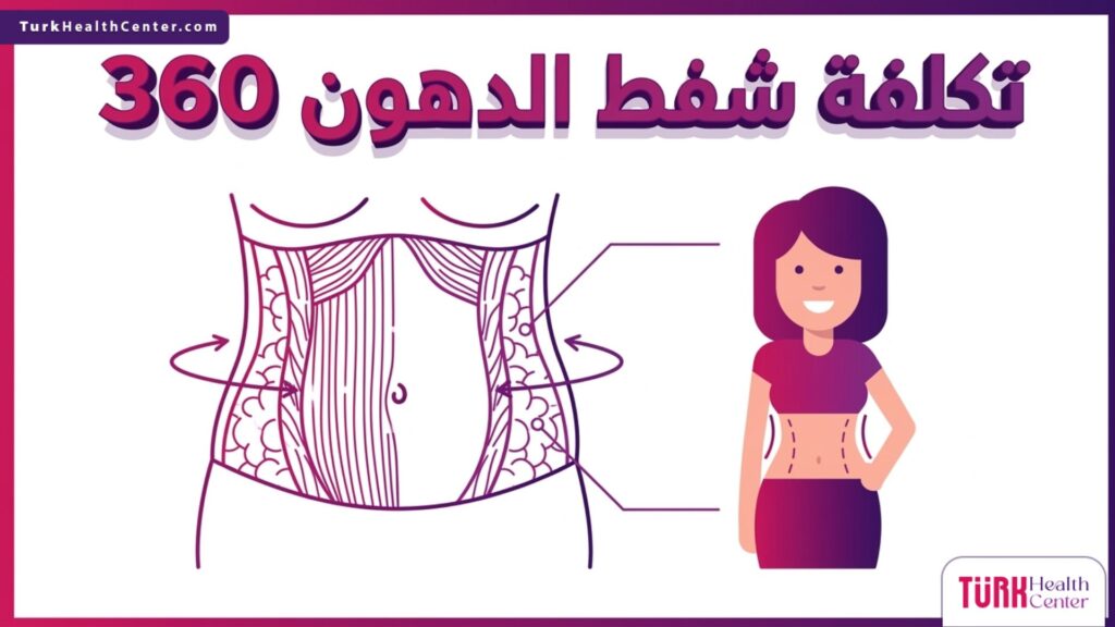 إنفوجرافيك طبي دقيق يوضح الطبقات الدهنية وآلية النحت المرتبطة بـ تكلفة شفط الدهون 360