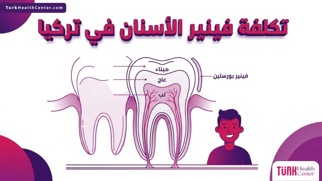 إنفوجرافيك تشريحي يوضح بنية السن و تكلفة فينير الأسنان في تركيا