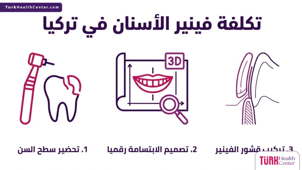 ملصق إنفوجرافيك يوضح خطوات و تكلفة فينير الأسنان في تركيا