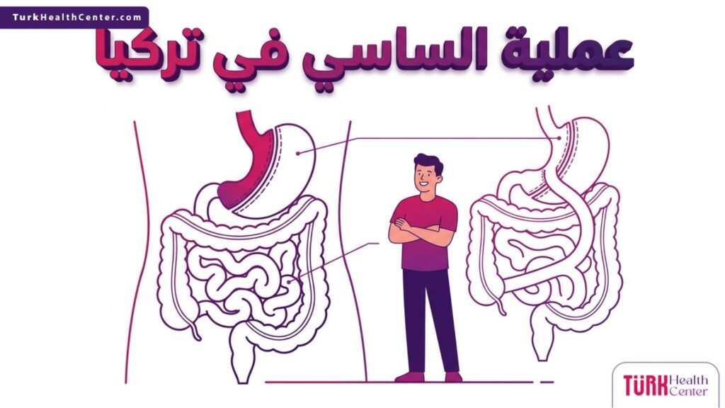 إنفوجرافيك تشريحي دقيق يوضح مسار المعدة والأمعاء في عملية الساسي في تركيا