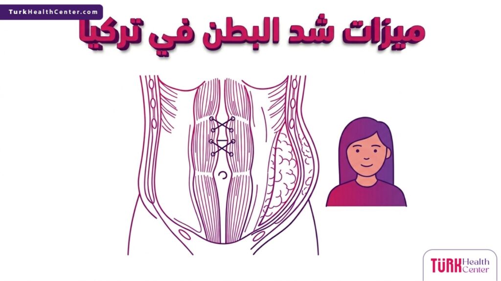 إنفوجرافيك طبي دقيق يشرح التشريح الداخلي و ميزات شد البطن في تركيا.