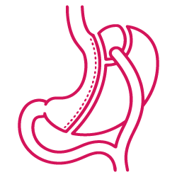 علاج السمنة