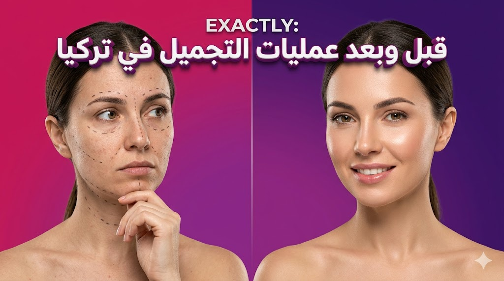  مقارنة واقعية قبل وبعد عمليات التجميل في تركيا تظهر علامات التخطيط الجراحي والنتائج النهائية المذهلة.
