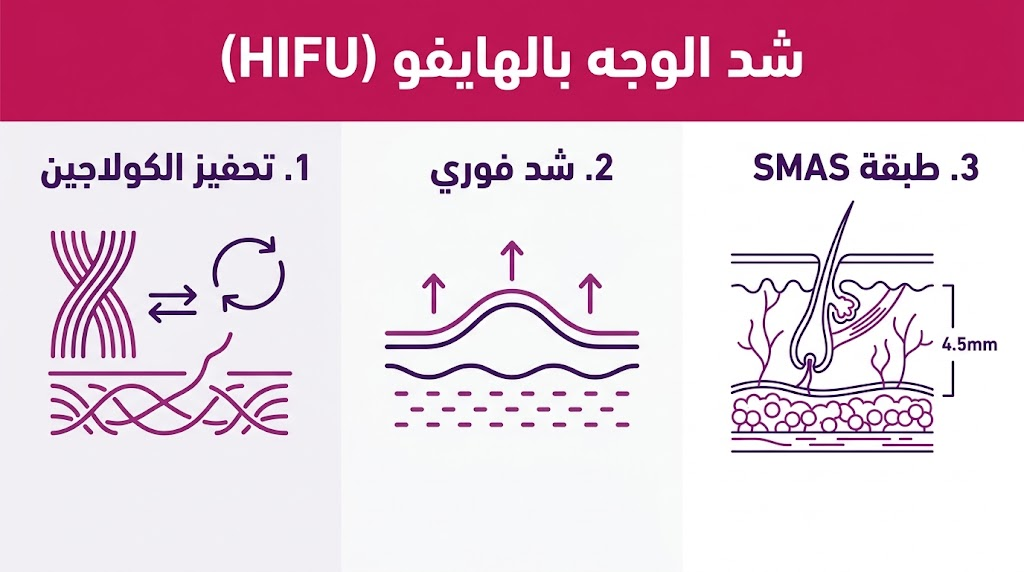 بوستر إنفوجرافيك علمي يلخص مميزات شد الوجه بالهايفو (HIFU) في ثلاث نقاط أساسية.