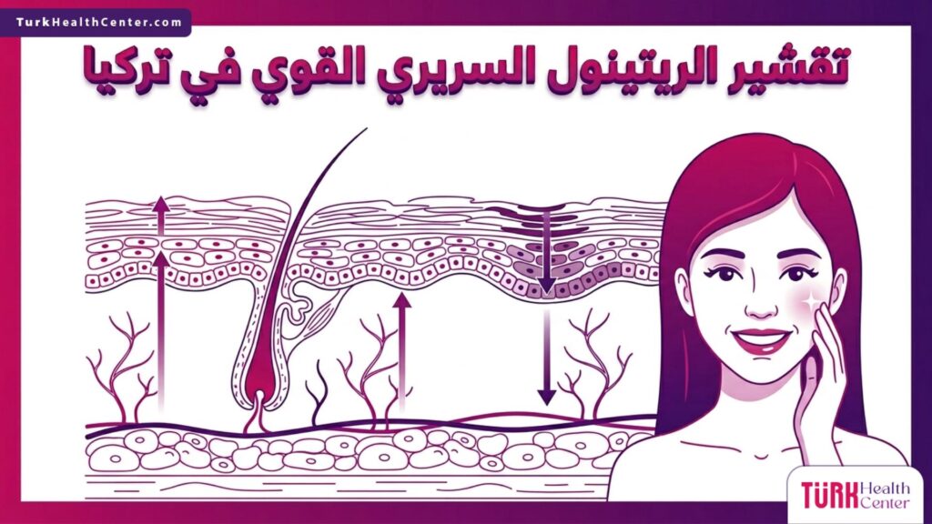 رسم توضيحي طبي لطبقات الجلد يوضح آلية عمل تقشير الريتينول السريري القوي في تركيا