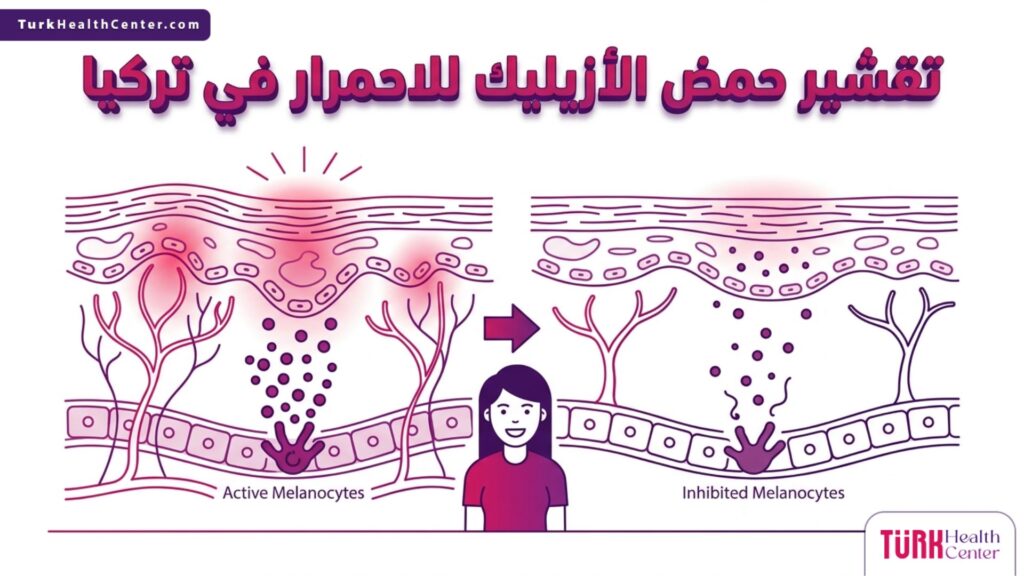 رسم بياني طبي دقيق يوضح تأثير تقشير حمض الأزيليك للاحمرار في تركيا على طبقات الجلد الداخلية وتقليل الالتهاب.