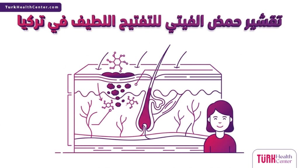 رسم تشريحي طبي يوضح آلية عمل تقشير حمض الفيتي للتفتيح اللطيف في تركيا داخل طبقات الجلد