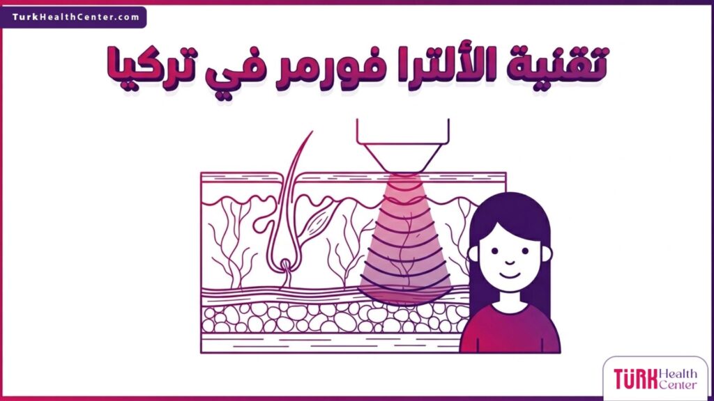 إنفوجرافيك تشريحي دقيق يوضح كيفية عمل تقنية الألترا فورمر في تركيا واختراق الموجات فوق الصوتية لطبقات الجلد العميقة لتحفيز الكولاجين.