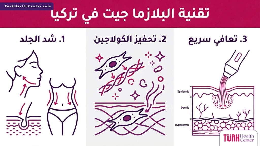 إنفوجرافيك يوضح المزايا الثلاث الرئيسية المتعلقة بـ تقنية البلازما جيت في تركيا.
