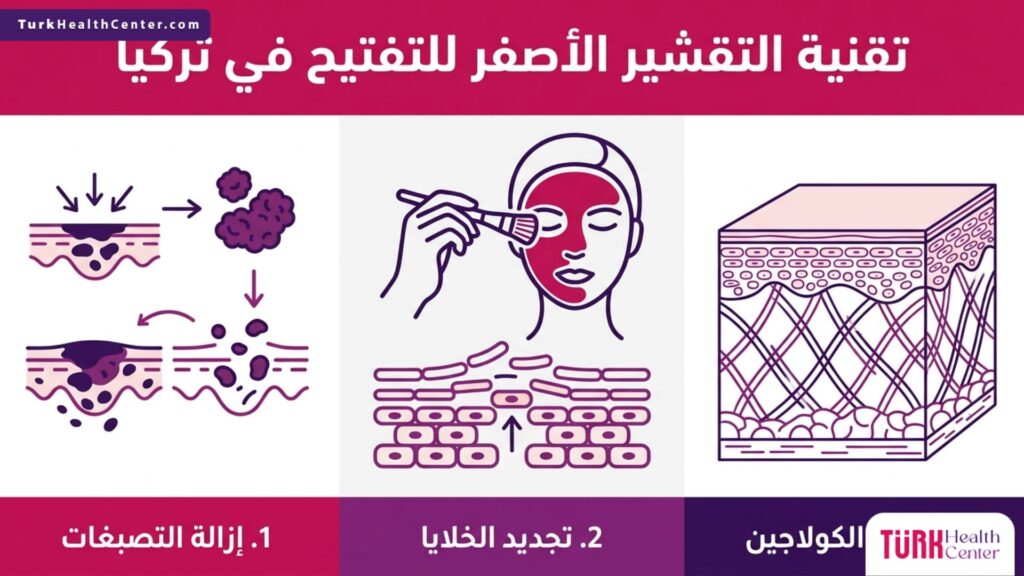 إنفوجرافيك علمي يشرح مراحل وفوائد تقنية التقشير الأصفر للتفتيح في تركيا.