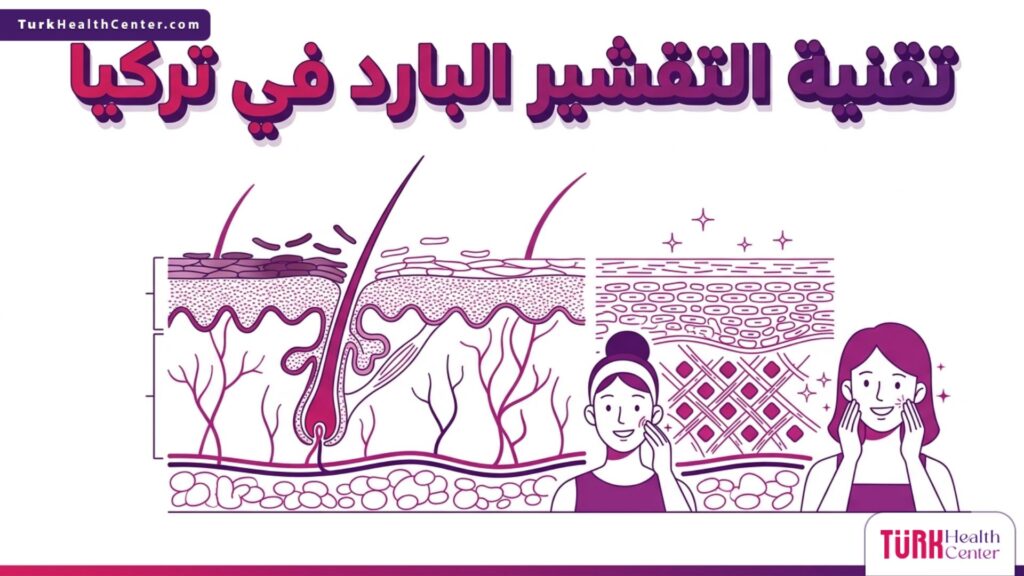 إنفوجرافيك طبي دقيق يشرح آلية عمل تقنية التقشير البارد في تركيا على طبقات الجلد الداخلية