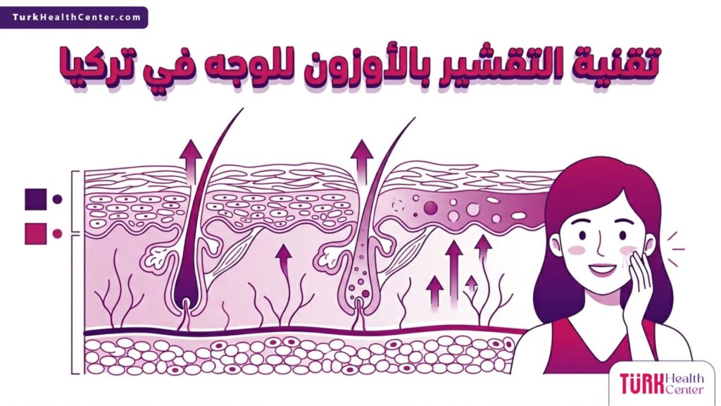 رسم إنفوجرافيك طبي دقيق يوضح الطبقات الداخلية للبشرة وآلية عمل تقنية التقشير بالأوزون للوجه في تركيا لتنقية المسام وتجديد الخلايا.