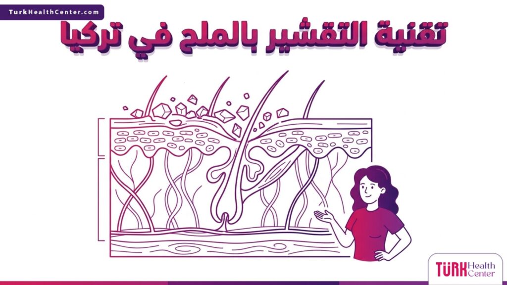 رسم تشريحي هندسي يوضح آلية عمل تقنية التقشير بالملح في تركيا داخل طبقات الجلد