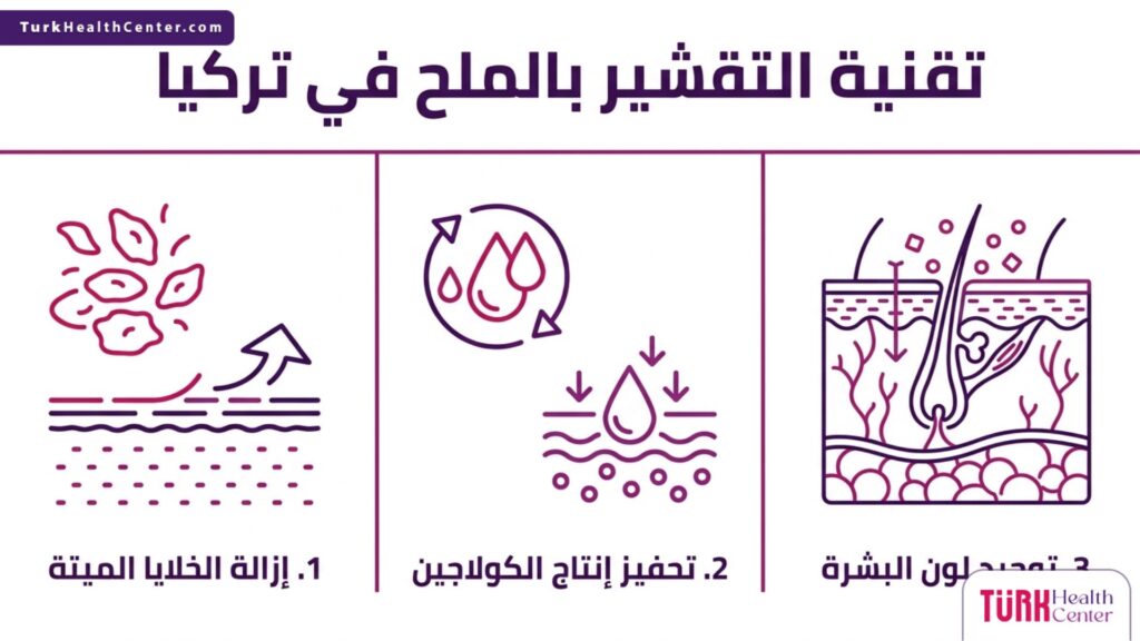 إنفوجرافيك طبي تفصيلي يشرح مراحل وفوائد تقنية التقشير بالملح في تركيا