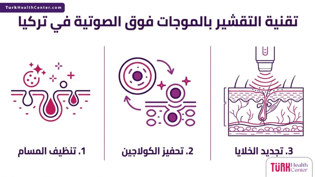 إنفوجرافيك طبي يشرح فوائد تقنية التقشير بالموجات فوق الصوتية في تركيا في 3 خطوات علمية
