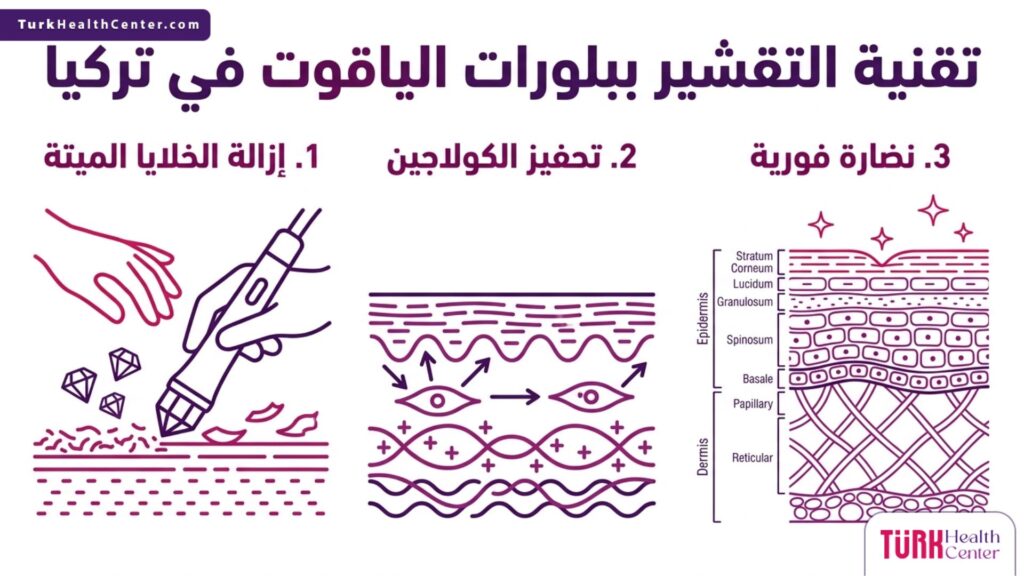 إنفوجرافيك يوضح ثلاث خطوات أساسية وفوائد علمية لإجراء تقنية التقشير ببلورات الياقوت في تركيا.