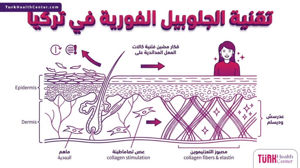رسم تشريحي طبي يوضح آلية عمل تقنية الجلو بيل الفورية في تركيا على طبقات الجلد