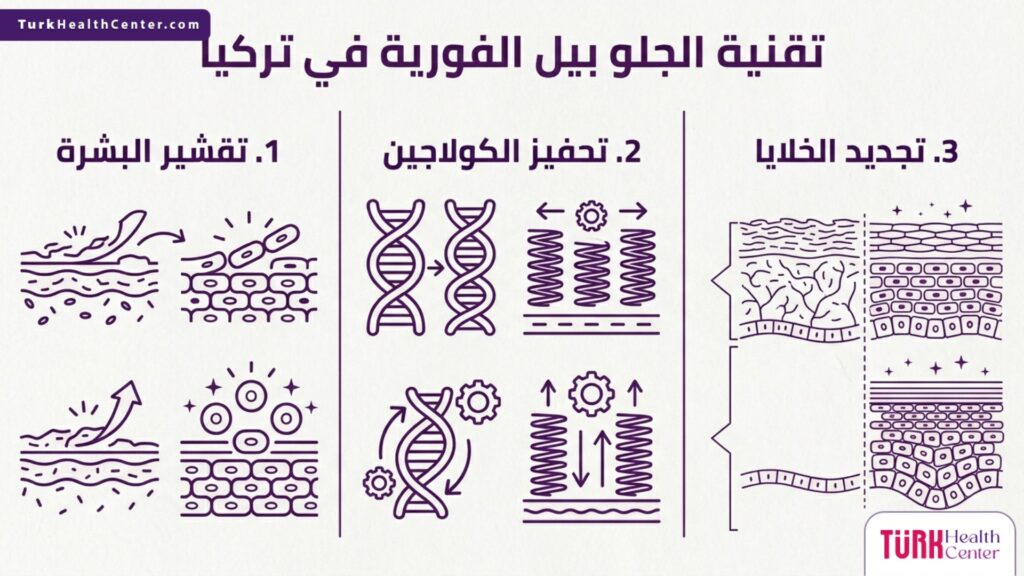 إنفوجرافيك طبي يوضح فوائد ومراحل تقنية الجلو بيل الفورية في تركيا