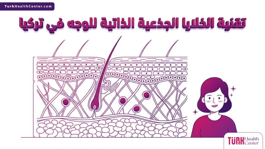 رسم توضيحي طبي يشرح آلية عمل تقنية الخلايا الجذعية الذاتية للوجه في تركيا داخل طبقات الجلد.