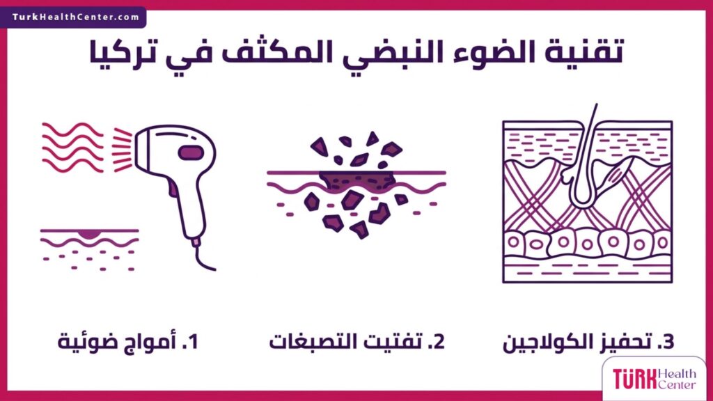 إنفوجرافيك طبي يستعرض خطوات وفوائد تقنية الضوء النبضي المكثف في تركيا للعناية بالبشرة.