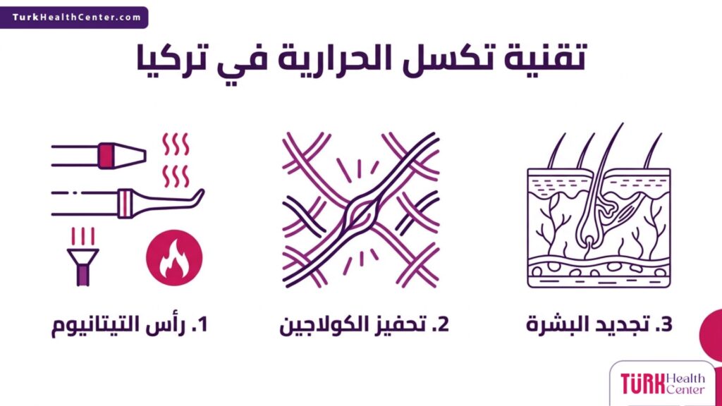 إنفوجرافيك طبي يشرح خطوات وفوائد تقنية تكسل الحرارية في تركيا لتحسين نسيج الجلد.