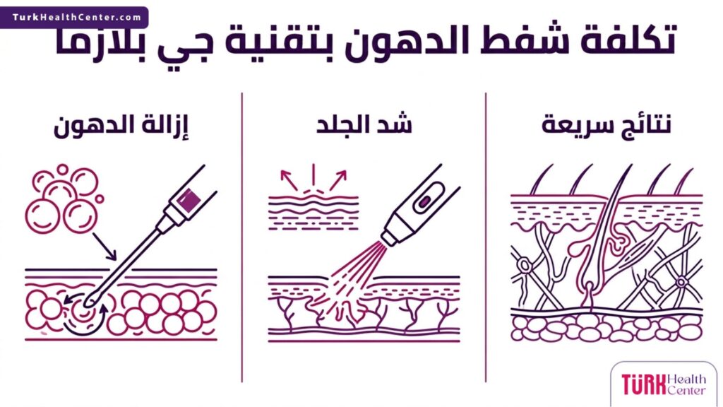 إنفوجرافيك طبي يوضح الخطوات والمميزات التي تبرر تكلفة شفط الدهون بتقنية جي بلازما بطريقة علمية.