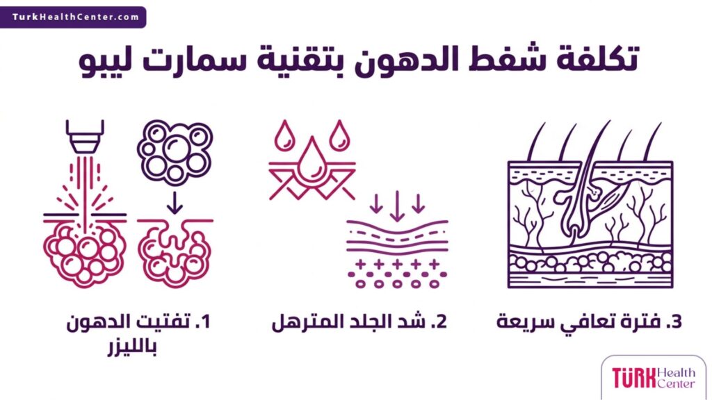 مخطط إنفوجرافيك يوضح المزايا الثلاثة الرئيسية المتعلقة بـ تكلفة شفط الدهون بتقنية سمارت ليبو