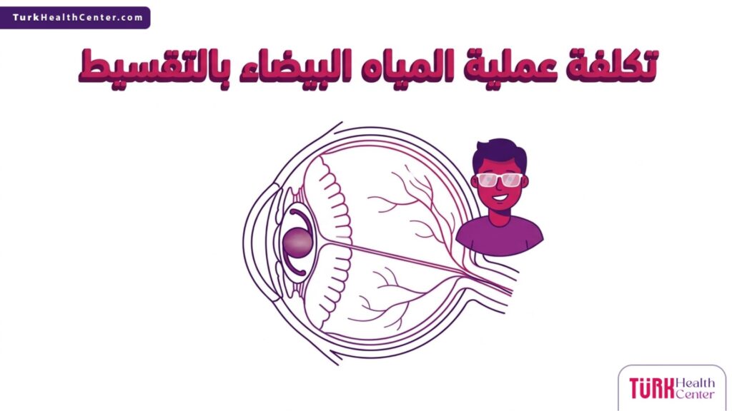 إنفوجرافيك طبي يوضح تشريح العين الداخلي وتفاصيل تكلفة عملية المياه البيضاء بالتقسيط.