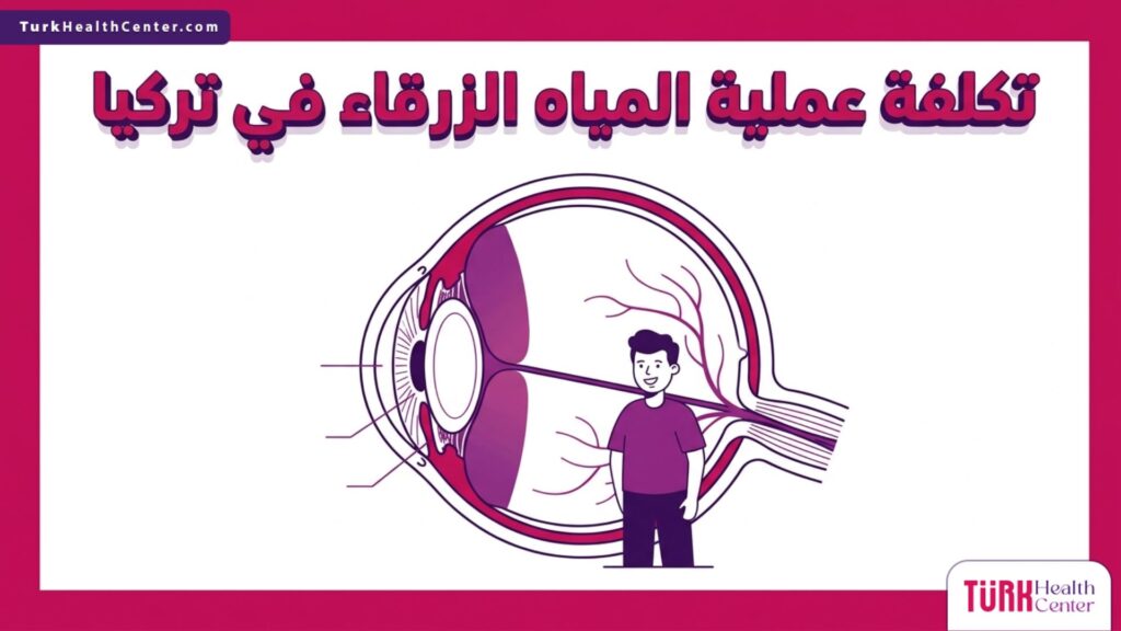 إنفوجرافيك طبي دقيق يوضح التشريح الداخلي للعين وكيفية تأثرها، مع التركيز على الجانب الطبي لـ تكلفة عملية المياه الزرقاء في تركيا.