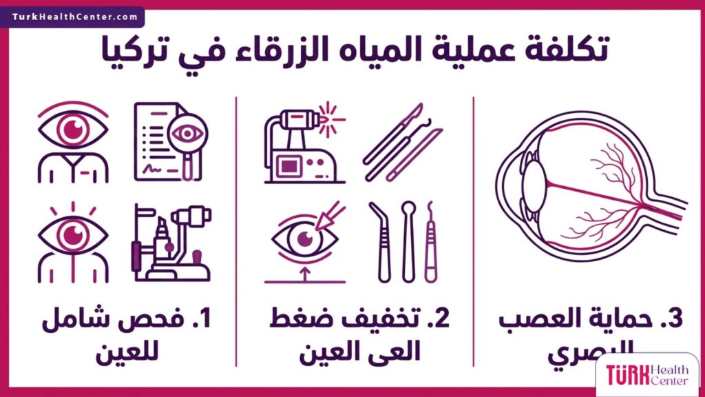 تصميم إنفوجرافيك يوضح ثلاث مراحل أساسية للعلاج وتشريح العين لتوفير معلومات متكاملة حول تكلفة عملية المياه الزرقاء في تركيا.