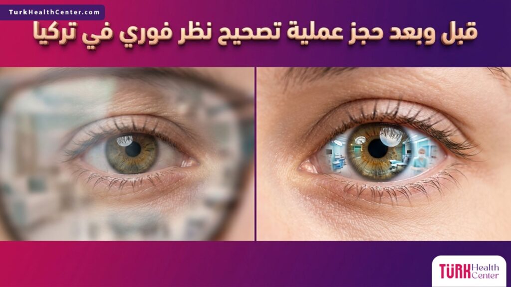 صورة "قبل وبعد" توضح نتائج حجز عملية تصحيح نظر فوري في تركيا بين الرؤية المشوشة والرؤية الواضحة.