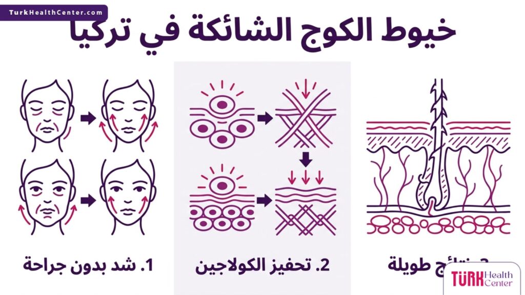 رسم بياني طبي يوضح فوائد وآلية استخدام خيوط الكوج الشائكة في تركيا للحصول على مظهر شاب.