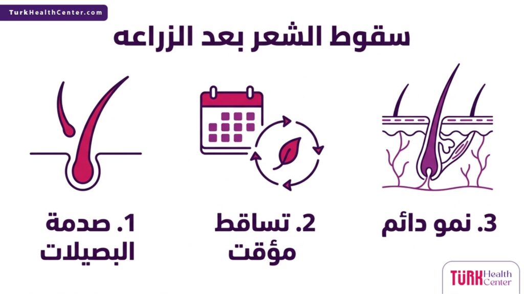 إنفوجرافيك طبي يشرح مراحل سقوط الشعر بعد الزراعه حتى مرحلة النمو الدائم