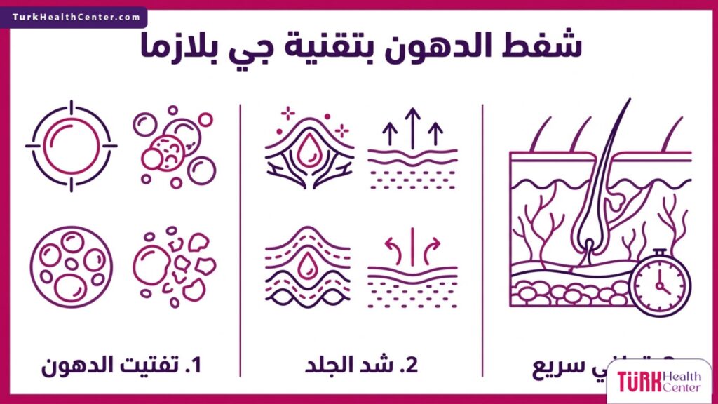 إنفوجرافيك يشرح خطوات وفوائد شفط الدهون بتقنية جي بلازما