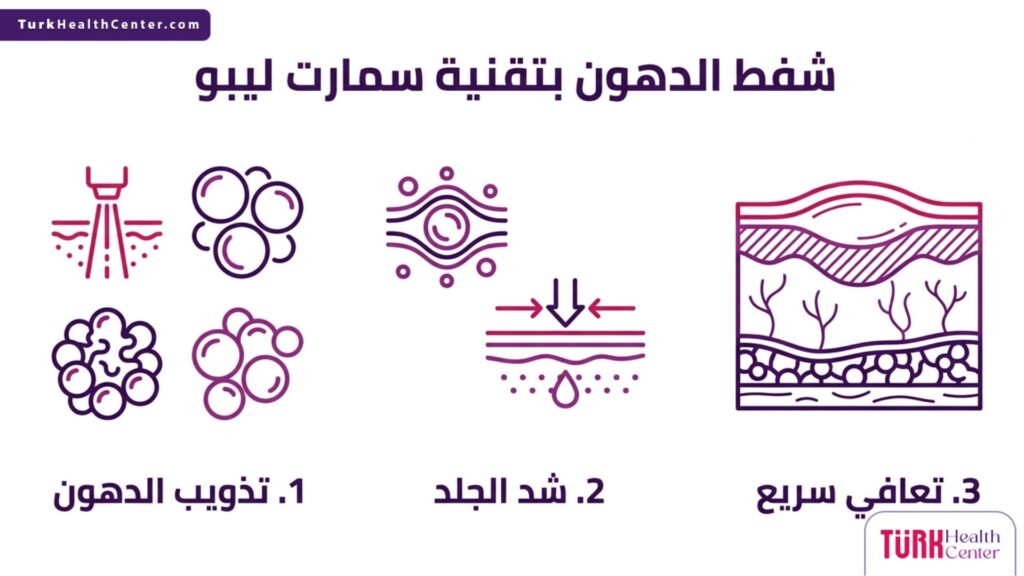 إنفوجرافيك يسلط الضوء على مزايا وخطوات شفط الدهون بتقنية سمارت ليبو.