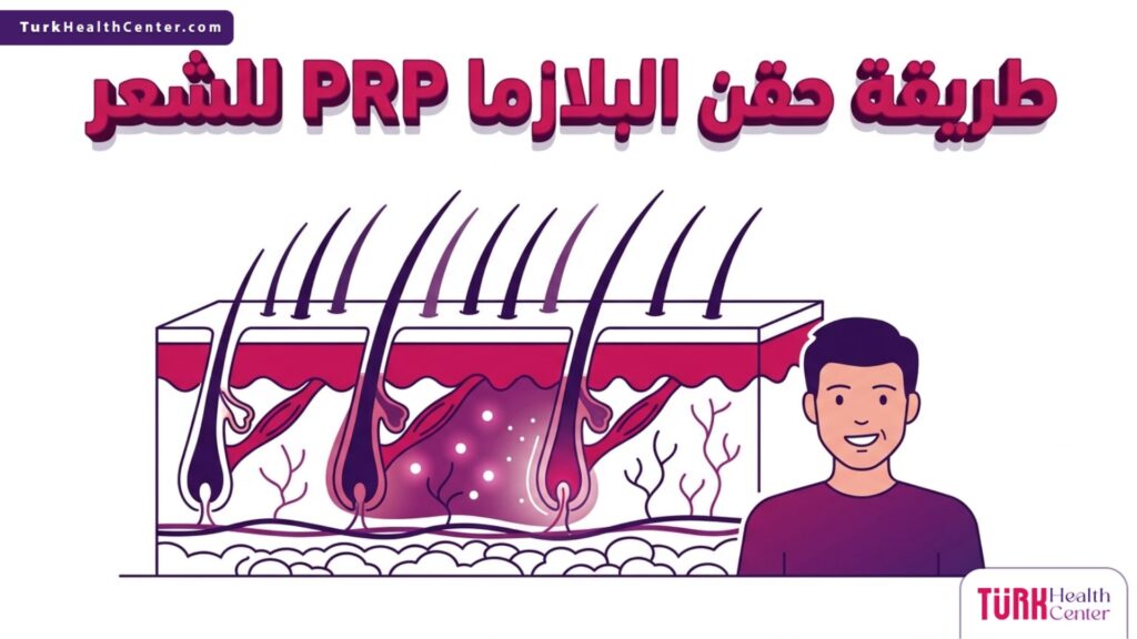 مخطط طبي تشريحي يوضح آلية عمل طريقة حقن البلازما PRP للشعر في تحفيز بصيلات الشعر داخل طبقات الجلد.