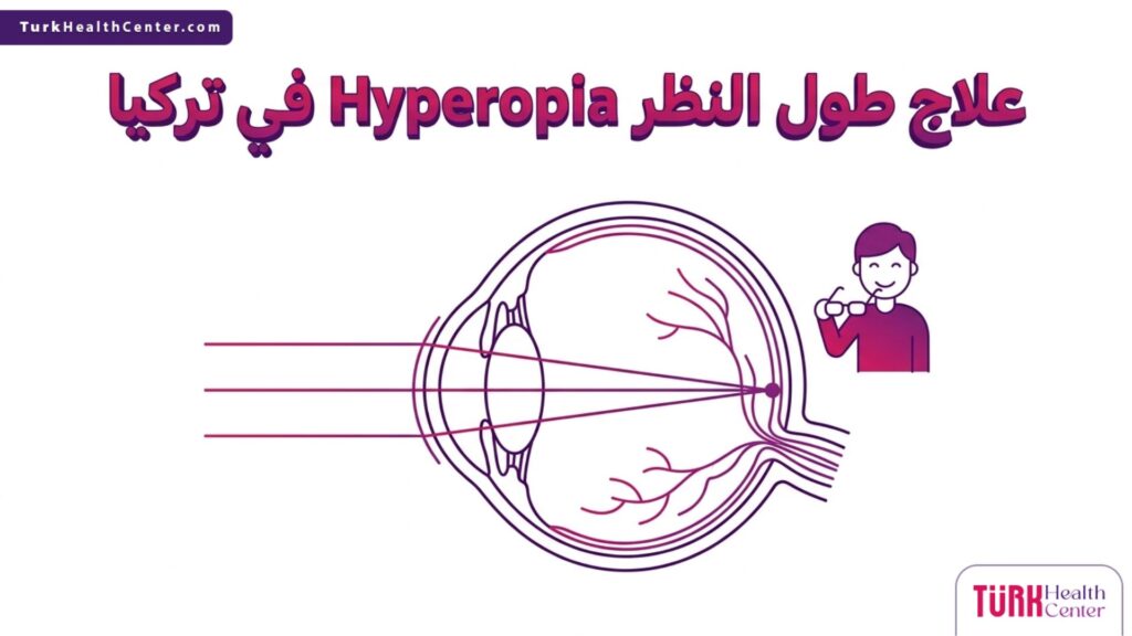 إنفوجرافيك تشريحي يوضح آلية انكسار الضوء داخل العين وكيفية علاج طول النظر Hyperopia في تركيا بدقة علمية.
