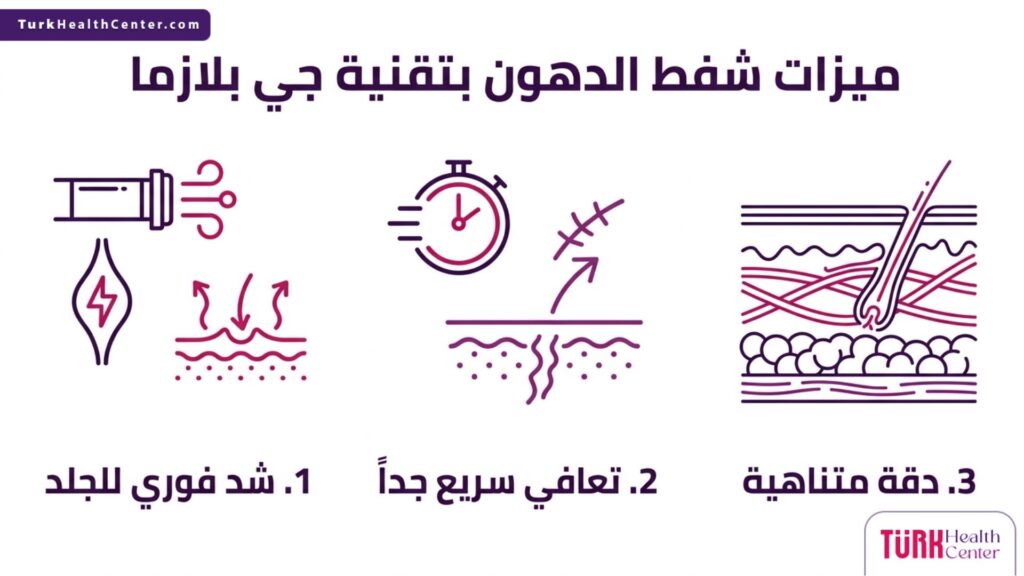 ملصق إنفوجرافيك طبي يسلط الضوء على أبرز 3 ميزات شفط الدهون بتقنية جي بلازما.