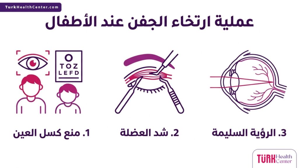 إنفوجرافيك طبي يشرح فوائد ومراحل عملية ارتخاء الجفن عند الأطفال بخطوات مبسطة.