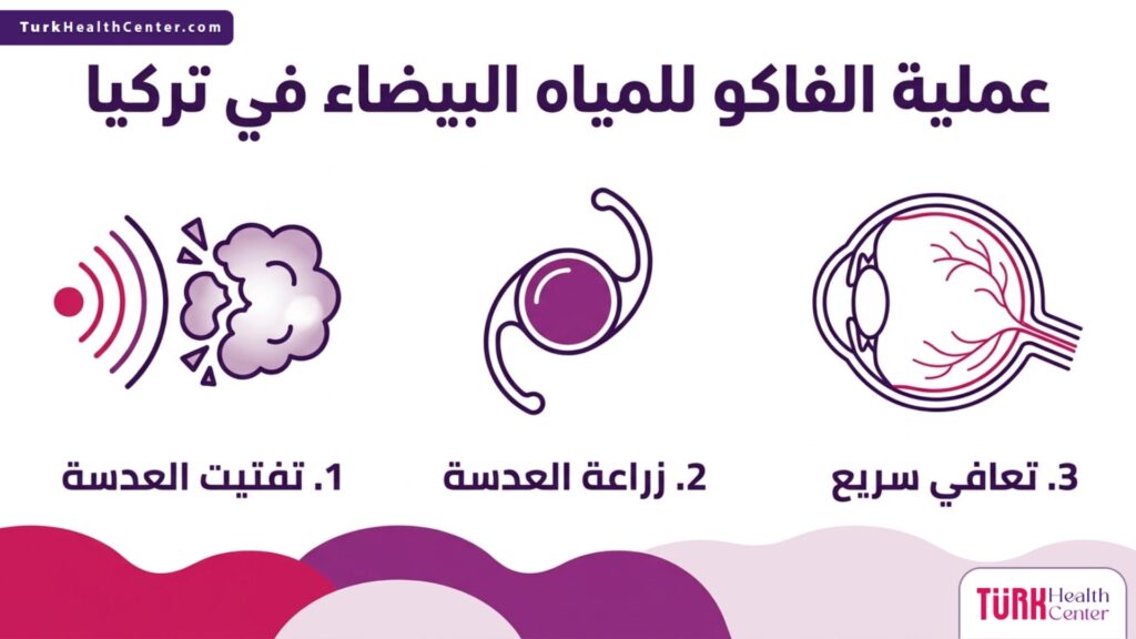 إنفوجرافيك طبي يشرح بخطوات مبسطة مراحل عملية الفاكو للمياه البيضاء في تركيا.