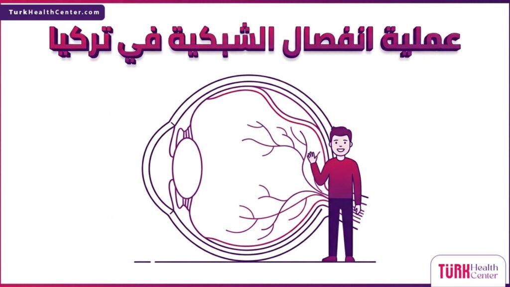 إنفوجرافيك طبي دقيق يوضح التشريح الداخلي للعين وخطوات عملية انفصال الشبكية في تركيا بشكل مبسط.