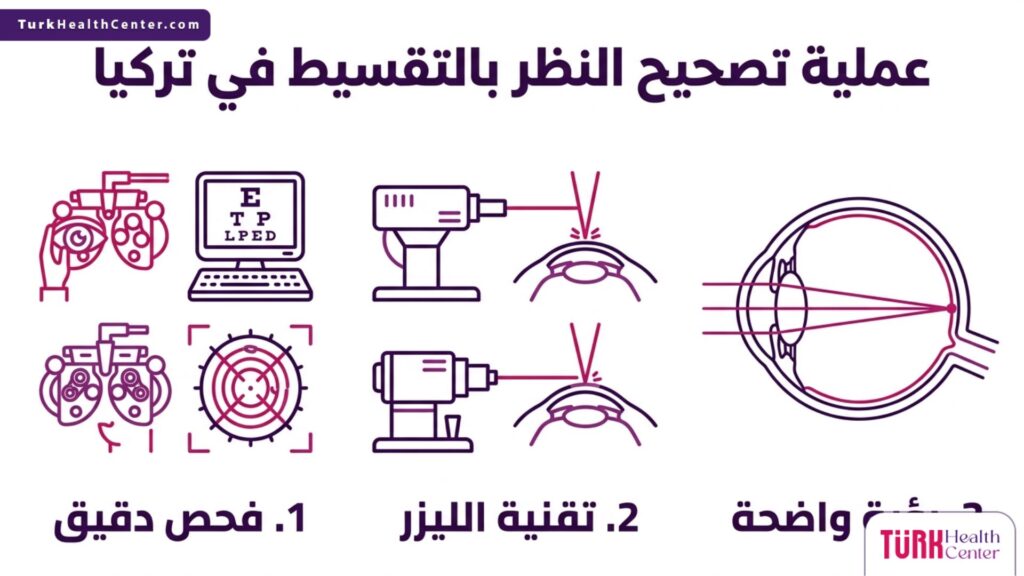 إنفوجرافيك يشرح الخطوات الثلاث الأساسية لإجراء عملية تصحيح النظر بالتقسيط في تركيا.