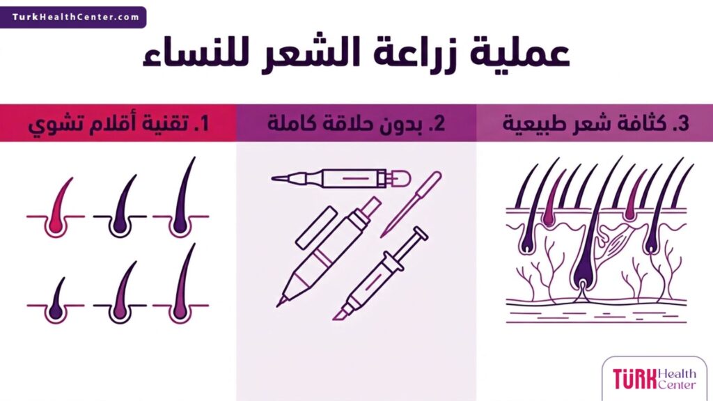 رسم بياني يوضح خطوات ومميزات عملية زراعة الشعر للنساء باستخدام أحدث التقنيات.