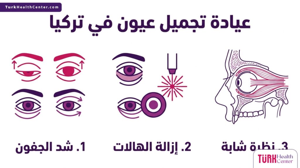 تصميم إنفوجرافيك يبرز ثلاث خطوات أساسية لنجاح العمليات في عيادة تجميل عيون في تركيا.