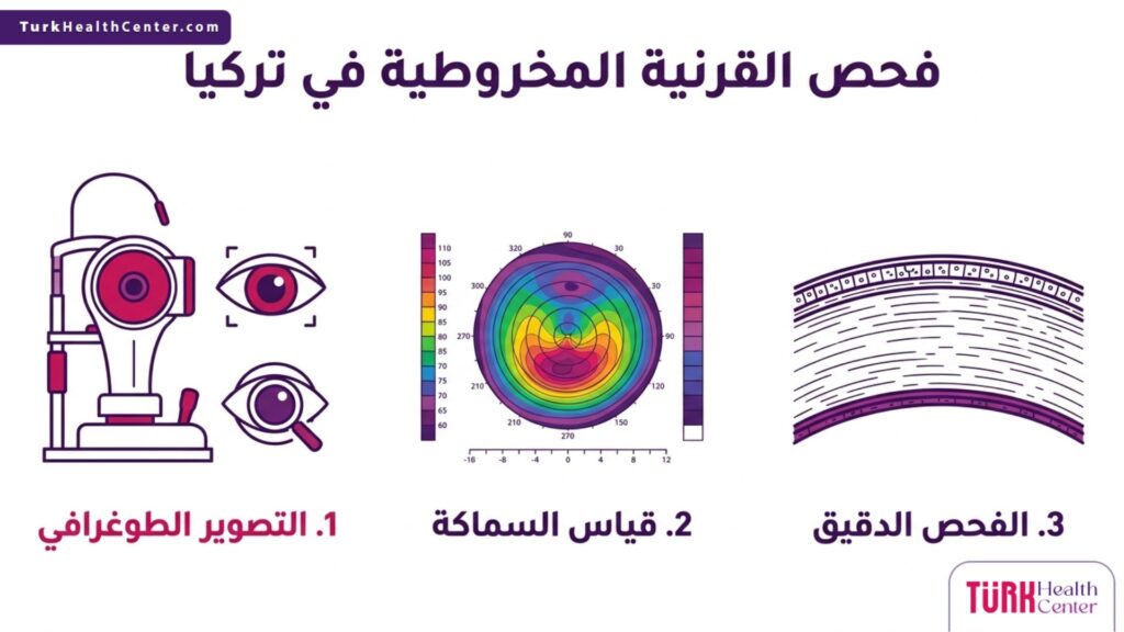 رسم بياني يوضح الخطوات الثلاث الأساسية لعملية فحص القرنية المخروطية في تركيا.
