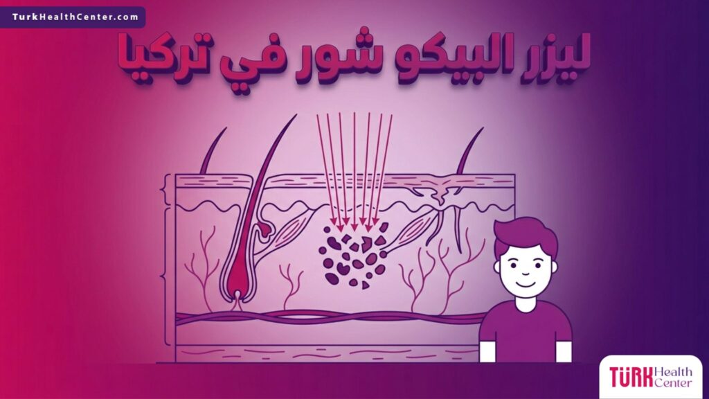 إنفوجرافيك طبي تشريحي يوضح آلية عمل ليزر البيكو شور في تركيا في اختراق طبقات الجلد وتفتيت جزيئات التصبغات العميقة بنبضات البيكو ثانية.